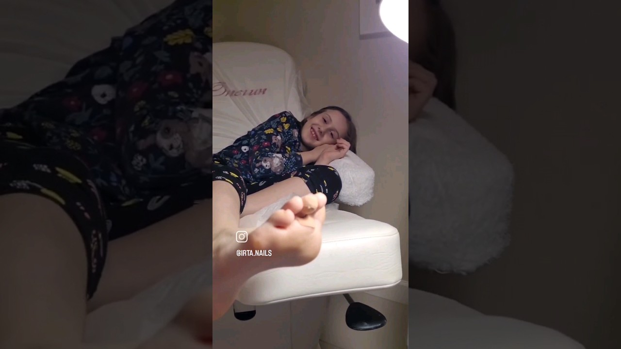 УДАЛЕНИЕ без боли #ШИПИЦЫ #красноярск #шипицакрасноярск #подология # ...