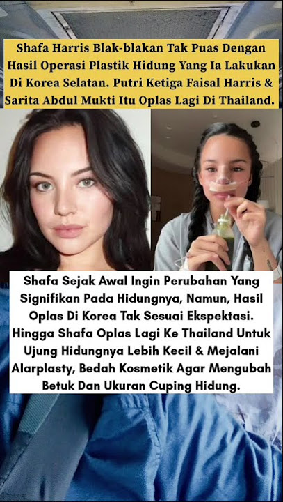 Shafa Harris Ungkap Alasan Tak Puas dengan Hasil Oplas Hidung di Korea.