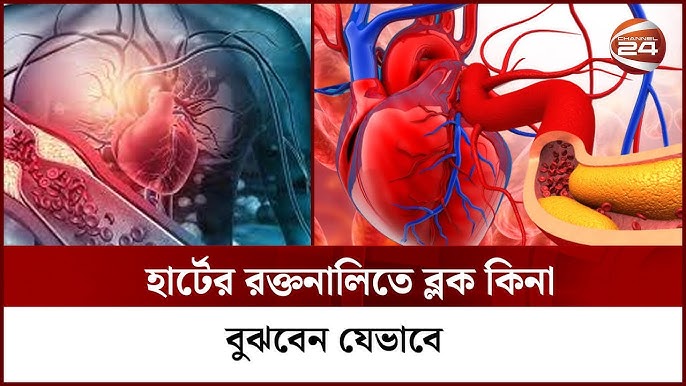 হার্ট ব্লক হওয়ার লক্ষণ: জানুন জরুরি সতর্কতা!