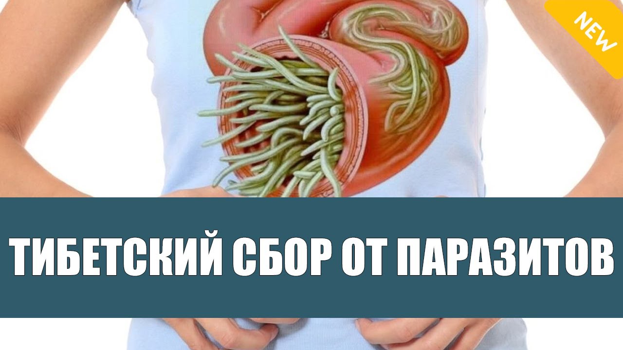 ЗАПАХ ИЗО РТА ИЗ ЗА ГЛИСТОВ ❕ БАЛЬЗАМ ОТ ПАРАЗИТОВ