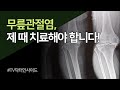 [TV 닥터 인사이드] 퇴행성 무릎 관절염, 치료 시기를 놓치지 말자!