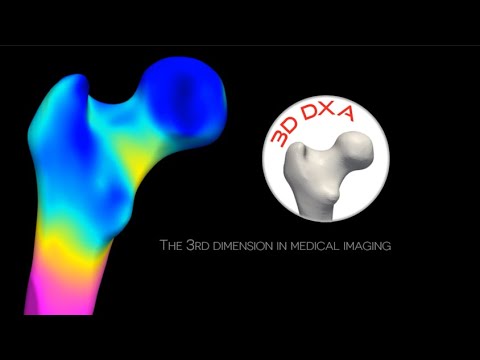 DMS Imaging | [EN] | 3D-DXA Technology - YouTube