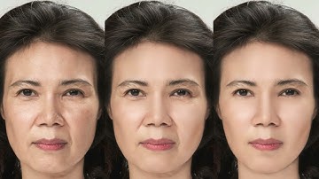Collagen Peptides Benefits — What Really Happens to Your Body When You Take Them