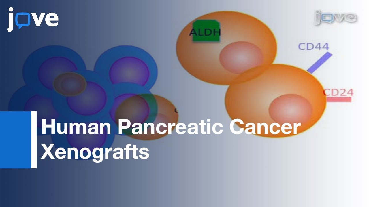Isolation: Stem Cells From Human Pancreatic Cancer Xenografts l Protocol Preview