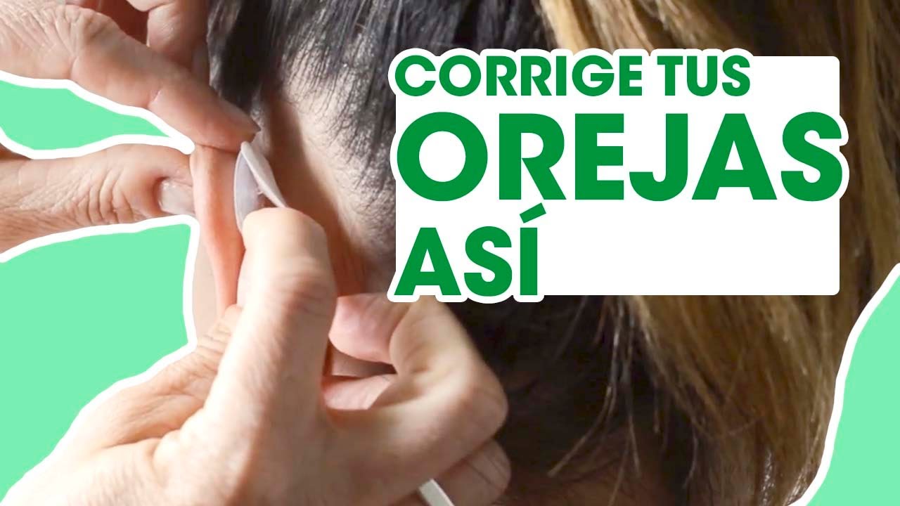 Otostick | Corrector estético para Orejas Separadas | Contiene 8  correctores.