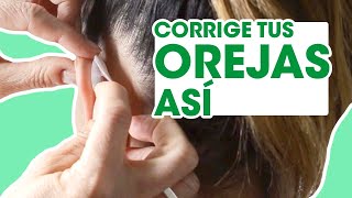 Comprar Otostick Corrector Orejas Adulto