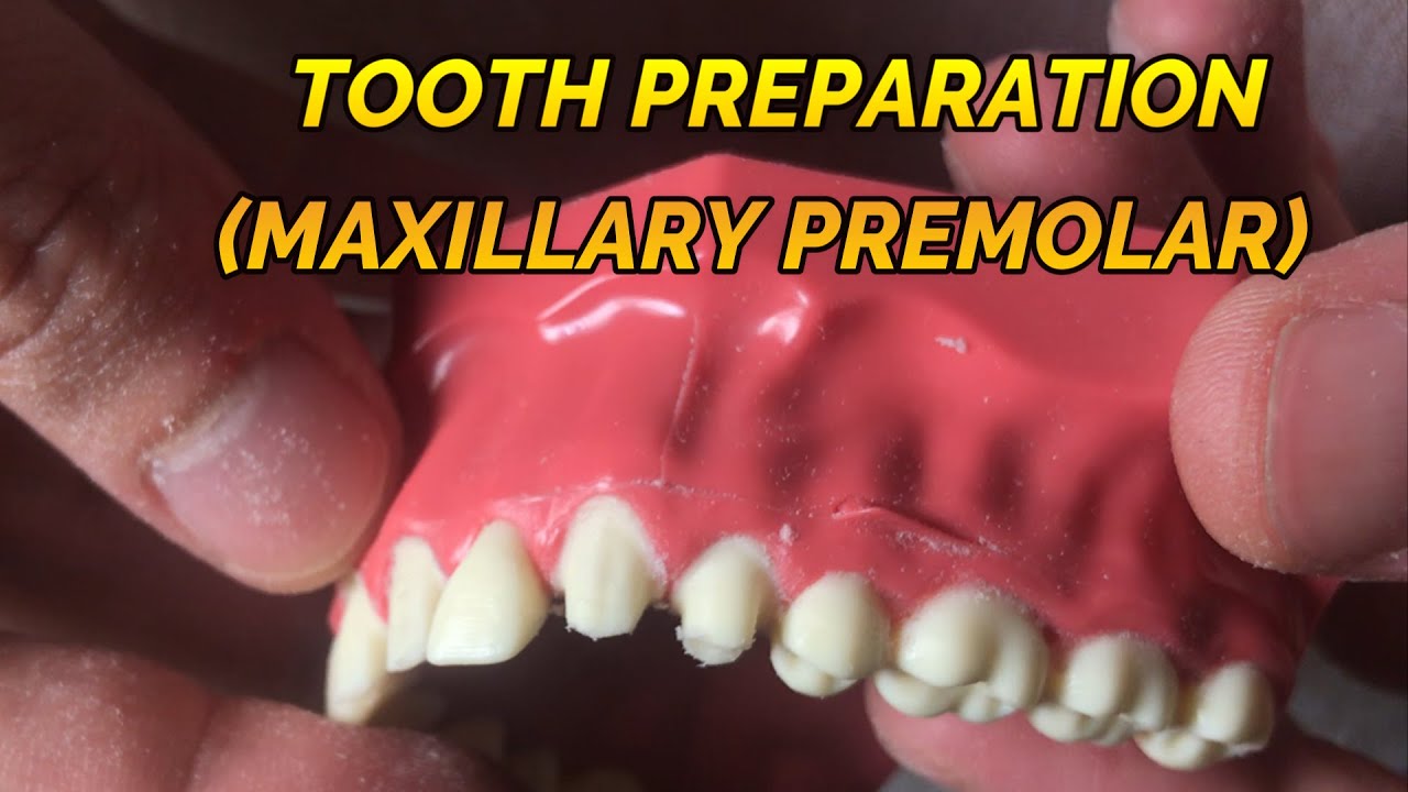 CROWN PREPARATION TUTORIAL (MAXILLARY PREMOLAR) YouTube