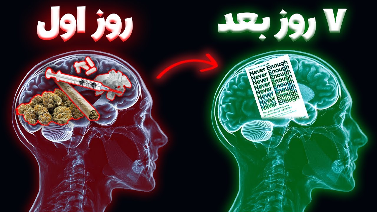 🕊️ ۳ راه واقعی برای رهایی از اعتیاد| داستان واقعی اعتیاد🚬🍺💉