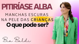 Pitiríase alba  | Dra. Beatriz Franchito Baldi