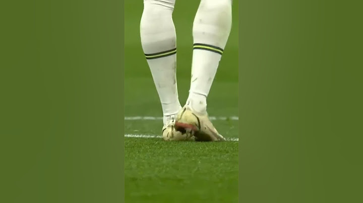😰 Momento da lesão do Richarlison no jogo entre Tottenham e Everton! Será que ele vai pra Copa?