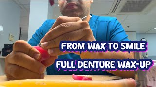 Full Denture Wax-Up March 2026