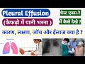 फेफड़ो में पानी के कारण और ईलाज के बारे में जानें | Pleural Effusion in Chest X-Ray@MLTLabManual2.0