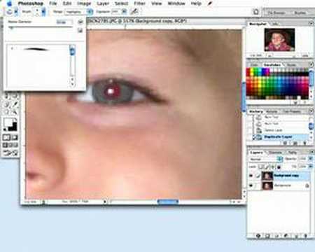 Red Eye Removal