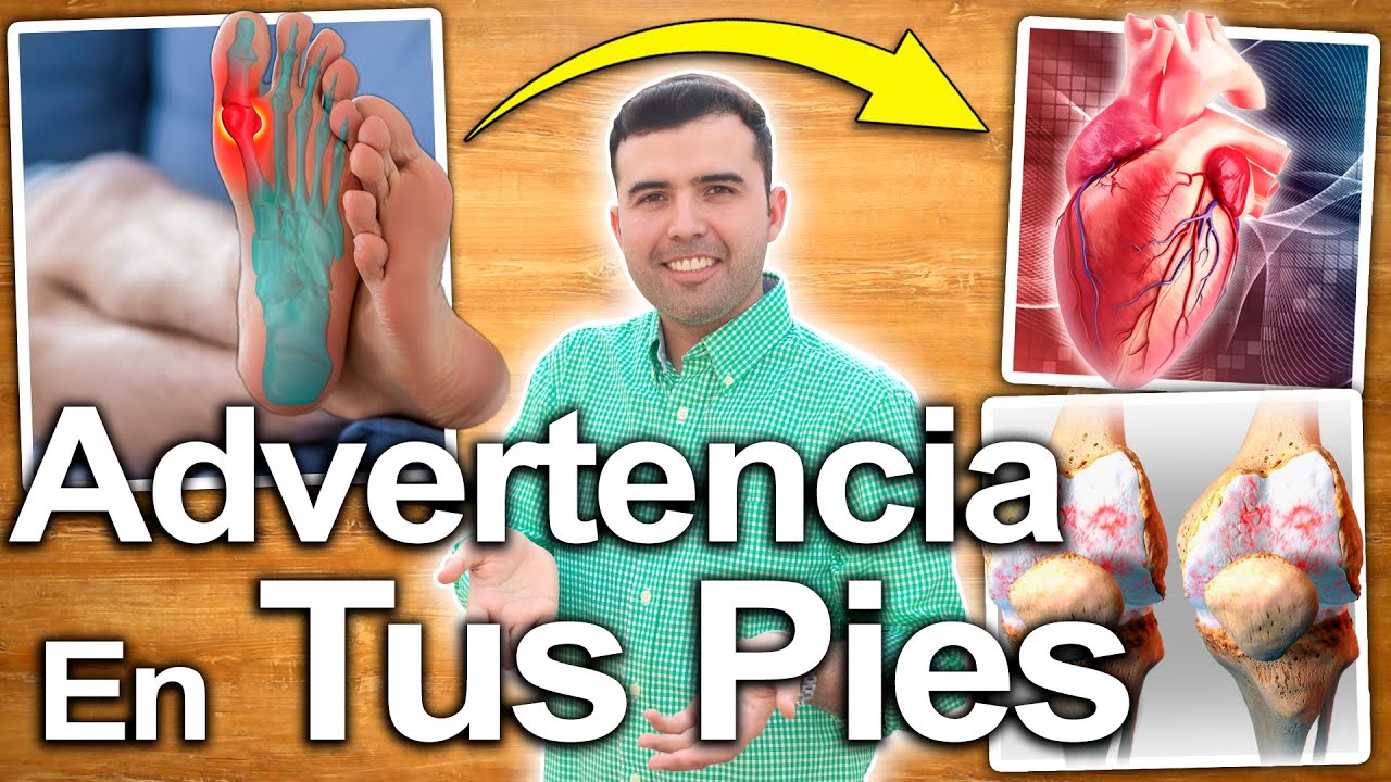 NO ES BUENA SE�AL SI VES ESTO EN TUS PIES - Signos y Sintomas Que No Debes Ignorar