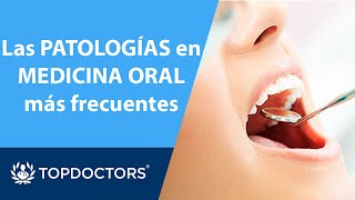 ODONTOLOGÍA: las PATOLOGÍAS🤕en MEDICINA ORAL más frecuentes | Top Doctors (2/4)