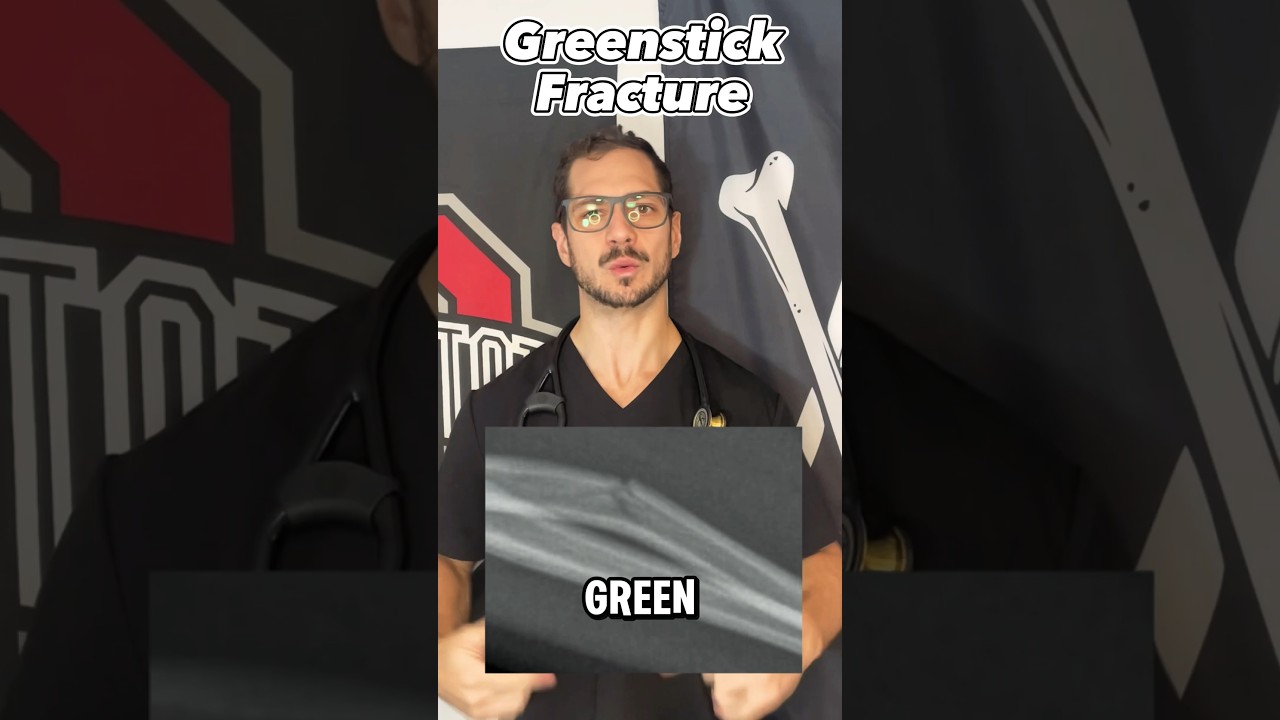 What Is A Greenstick Fracture? 