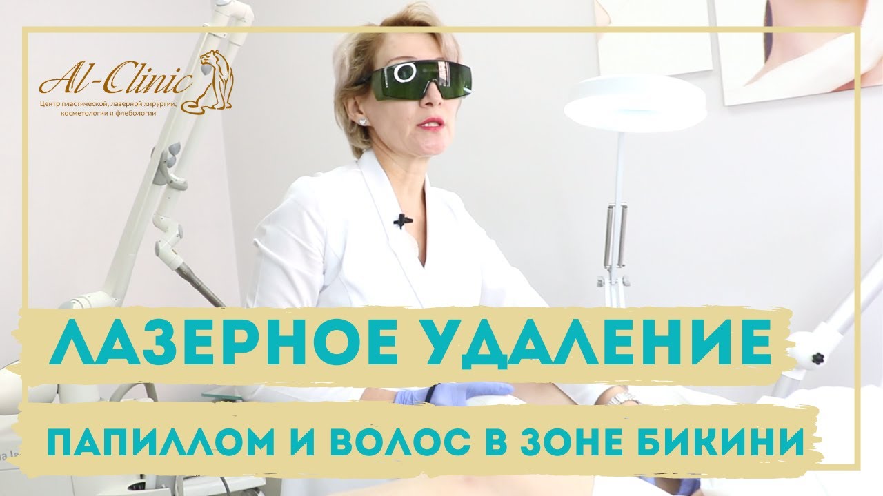 🔞Только 18+ | ИНТИМНОЕ УДАЛЕНИЕ ПАПИЛЛОМ и ЛАЗЕРНАЯ ЭПИЛЯЦИЯ БИКИНИ ...