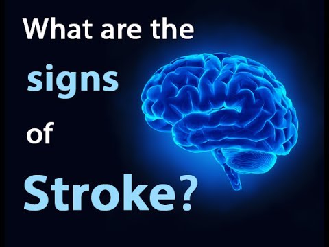 Stroke, Headache, Migraine, Numbness and Muscle pain, Brain tumor - by Dr Epi Collantes