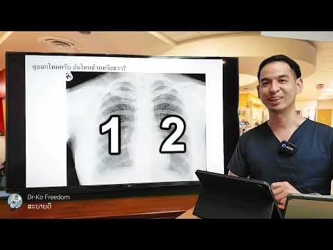 วีดีโอ: วิธีการอ่าน X-ray ทรวงอก (พร้อมรูปภาพ)