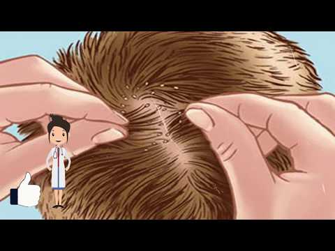 Video: 3 mënyra për të hequr qafe gungën e hundës