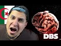 SKORP DBS REACTION MY SECOND CHANNEL 