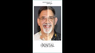 Transform Your Smile & Save Big! 💰✨ #DentalImplants #SmileMakeover