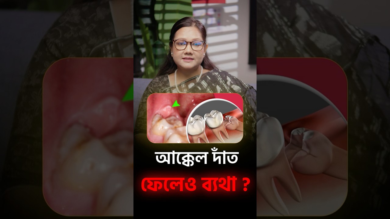 আক্কেল দাঁত তুলেও রক্ষা নেই? ব্যাথা কমছে না?  #dentist #BanglaHealthTips  #dentist  #dentalcare