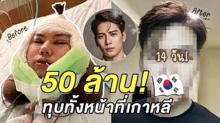 Ep.3 เส้นทางสู่ Jackson Wang 🇰🇷 ทุบทั้งหน้า 50 ล้านวอน ไหนใครบอกไม่เจ็บ! + อัพเดทหน้า 14 วัน