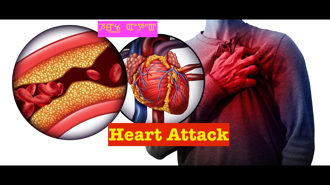 Heart Attack (Manipuri) ꯍꯔ꯭ꯠ  ꯑꯦꯇꯦꯛ