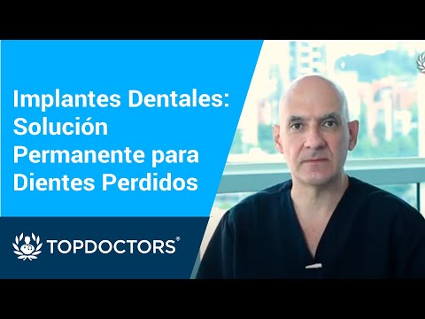 Implantes Dentales: Solución Permanente para Dientes Perdidos