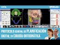 Protocolo general de Planificación Digital en Cirugía Ortognática