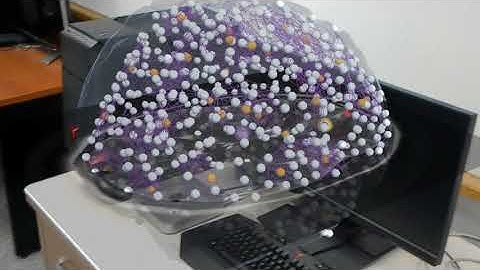 Brain network visualization with Microsoft Hololens