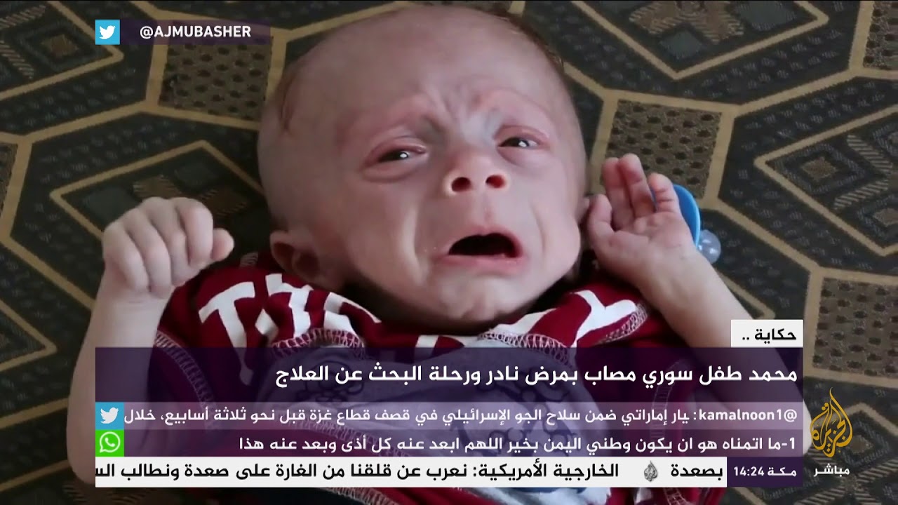 حكاية .. رحلة البحث عن العلاج لطفل سوري مصاب بمرض نادر