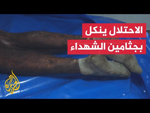 وزارة الصحة في غزة تؤكد ارتكاب الاحتلال جرائم قتل وإعدامات ميدانية وتعذيب ممنهج للشهداء