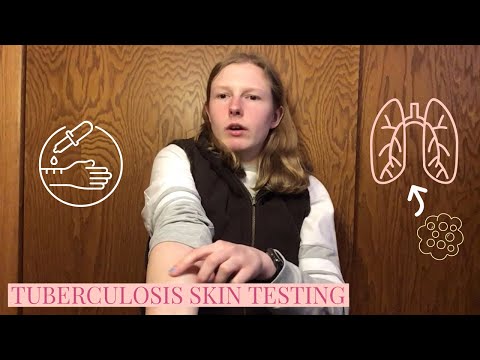 वीडियो: क्या तपेदिक परीक्षण आपको बीमार कर सकता है?