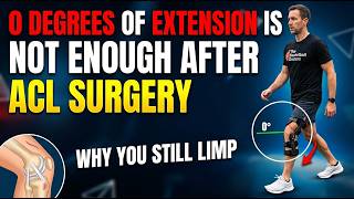 Stop Limping After ACL Surgery: The Missing Step
