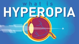 What is Hyperopia (Far-sightedness)?
