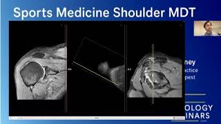 Sports Medicine Training Webinar: Ultrasound & Decision-Making with Colin, Dr. Irfan & Dr. Imran