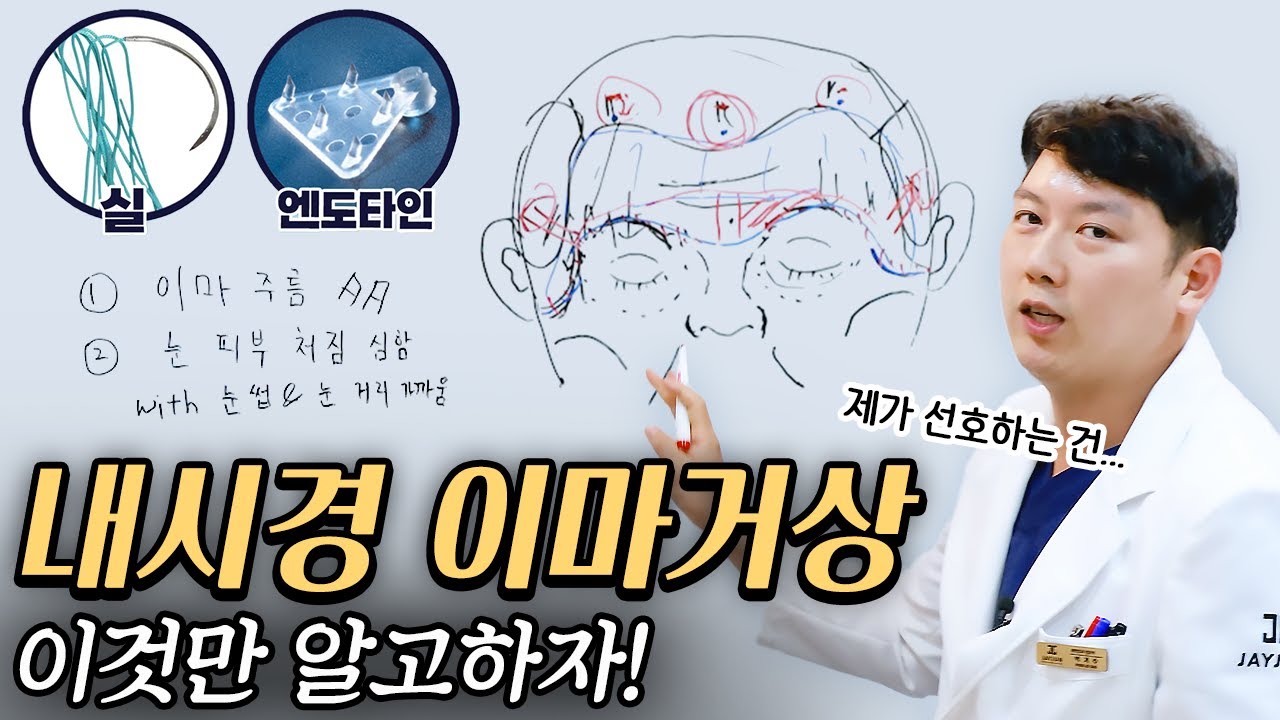 [JAYJUN Phẫu thuật thẩm mỹ & Da liễu] Mắt sụp và nếp nhăn trán thì sao? Nâng trán nội soi! Chỉ cần xem video này là hết lo lắng!