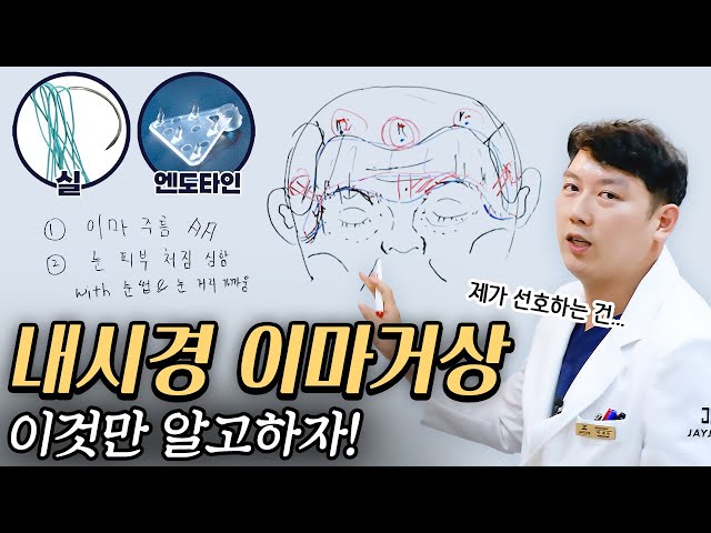 눈 처짐과 이마주름엔? 내시경 이마거상! 이 영상 하나면 고민 끝!