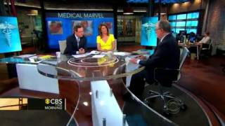 Device helps deaf child hear for the first time   CBS News Video News