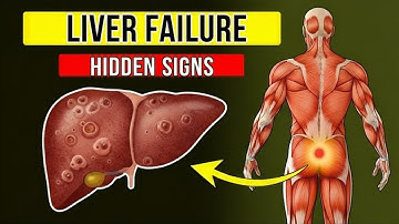 THE LIVER IS FAILING! Hidden Signs Nobody Knows About