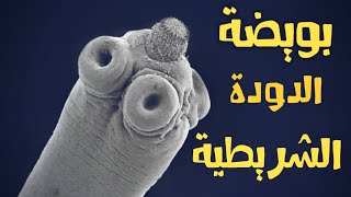 بويضة الدودة الشريطية من تحت الميكرسكوب  H.nana