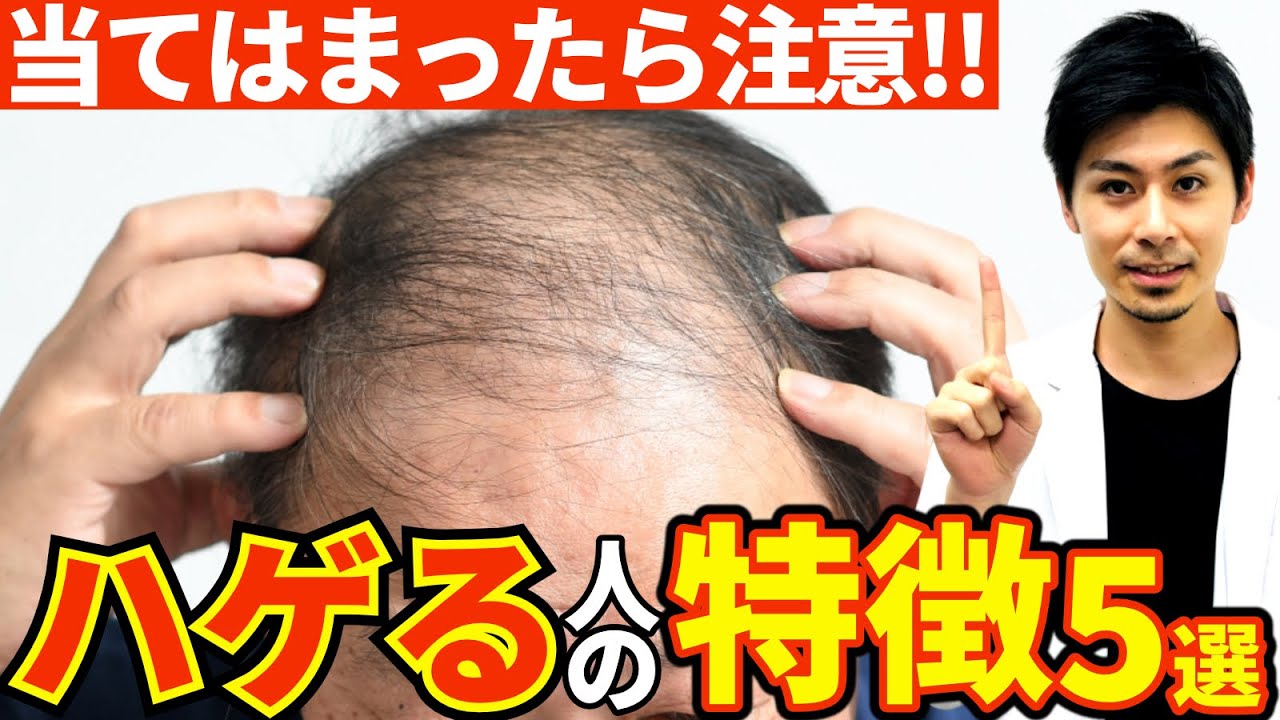 ハゲる人の特徴5選!【薄毛】 - YouTube