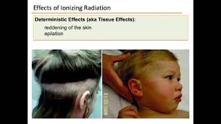 Radiation Biology Part 2 - Deterministic Effects