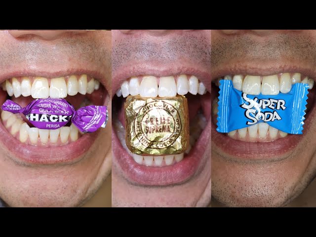 🍬 Candy Crunch Extravaganza: Today's Most-Viewed ASMR Delights! #ChocoJoy #SweetSounds #TopViews class=