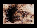 Ants Galore