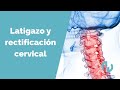 Latigazo cervical y rectificación cervical