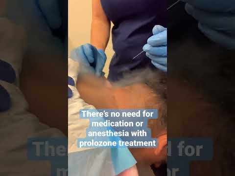THERE’S NO NEED FOR MEDICATION OR GENERAL ANESTHESIA WITH PROLOZONE THERAPY