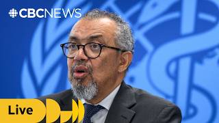 WHO holds briefing about Ebola outbreak